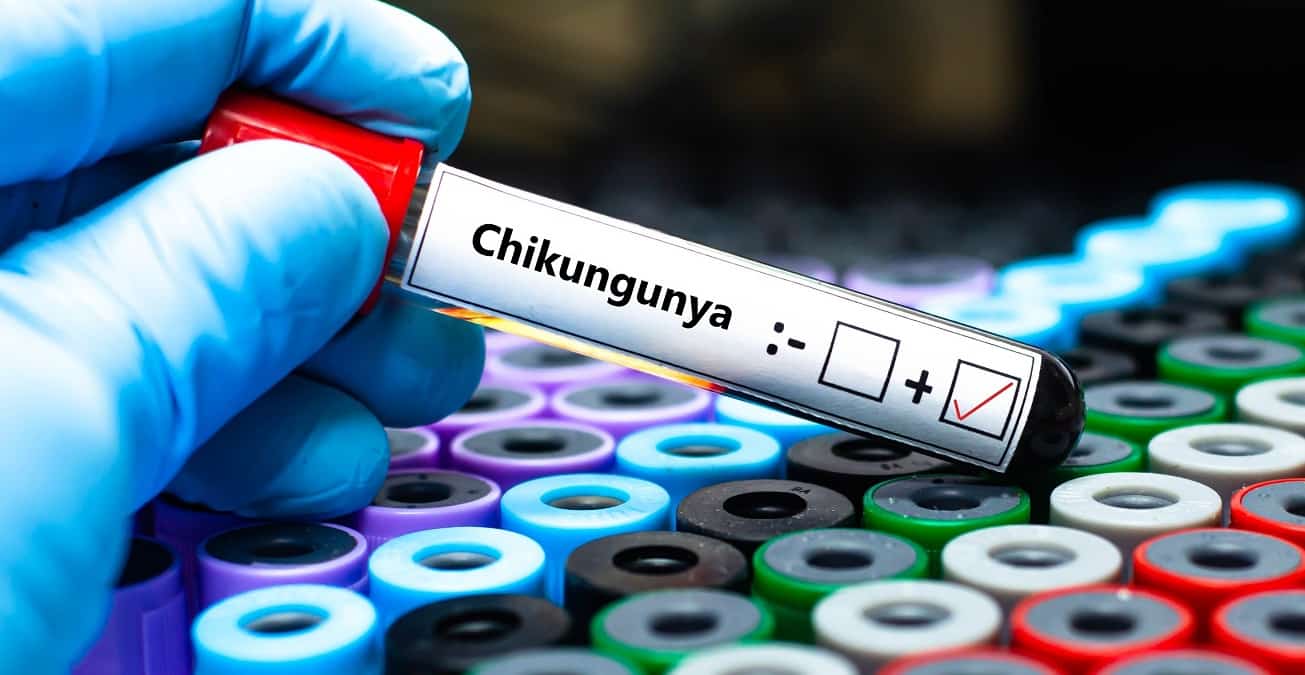 Vigilância pode prever epidemias de chikungunya; entenda